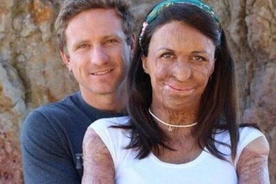 After a fire damaged his wife’s beauty, the husband refuses to leave her (NG)