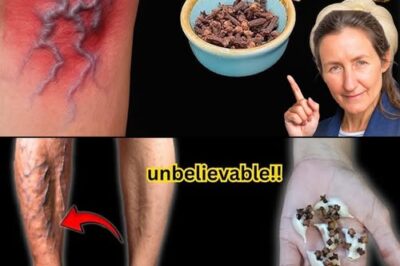 Ease Leg Pain and Support Joint Health Naturally with Garlic and Cloves