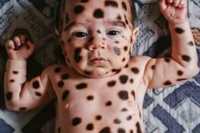 Mom shocked by her baby after birth, her words now spread like forest fire! (NG)