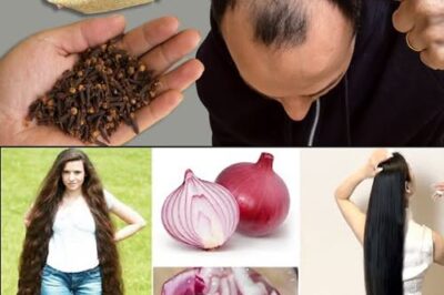 The Surprising Hair Growth Benefits of Cloves and Onion Peels