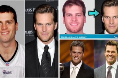 The Truth Behind Tom Brady’s Ageless Look: Botox Rumors Explode — What the NFL Icon Really Does to Stay Youthful